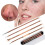 4PCS Blackhead Remover Pimple Comedone Extractor Tool Acne Kit 1