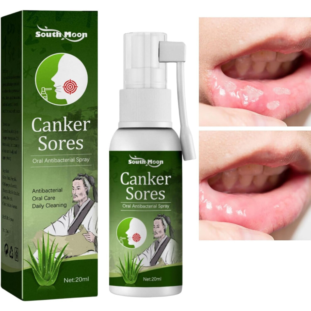 Gogerstar Mouth Ulcer Treatment Spray,Mouth Ulcer Spray,Mouth Ulcer Treatment For Adults,Canker Sore Treatment,Herbal Mouth Spray