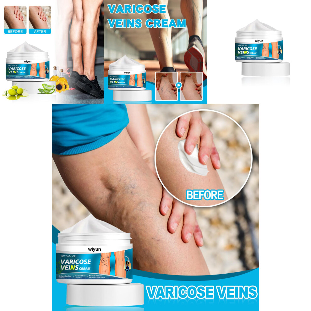 Therapeutic Wiyun Vein Care Cream For Muscle Relief And Vessel Massage Therapy 30g