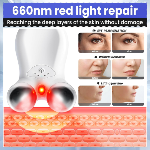Chronus Microcurrent Red Light Facial Device, Skin Lifting USB White 2