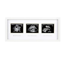Trimester Sonogram Picture Frame, Pregnancy Photo Milestone Wall Decor, Ultrasound Keepsake, Gender-Neutral Baby Nursery Décor, White
