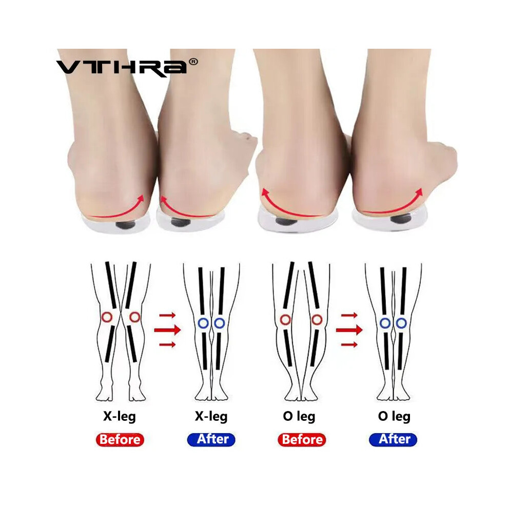 Vthra (Kids Eu 26-34) Magnets Silicon Orthopedic Insoles Legs Knee Varus Correction Heel Pads