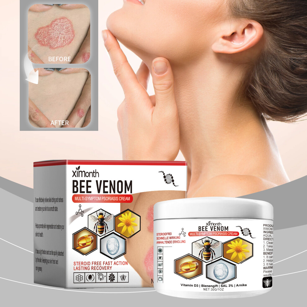 Gentle Cowhide Psoriasis Bee Venom Cream For Skin Itch Relief And Intensive Care