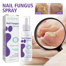 Repair Gray Nail Spray For Healthy Soft Nails And Thickened Cuticles