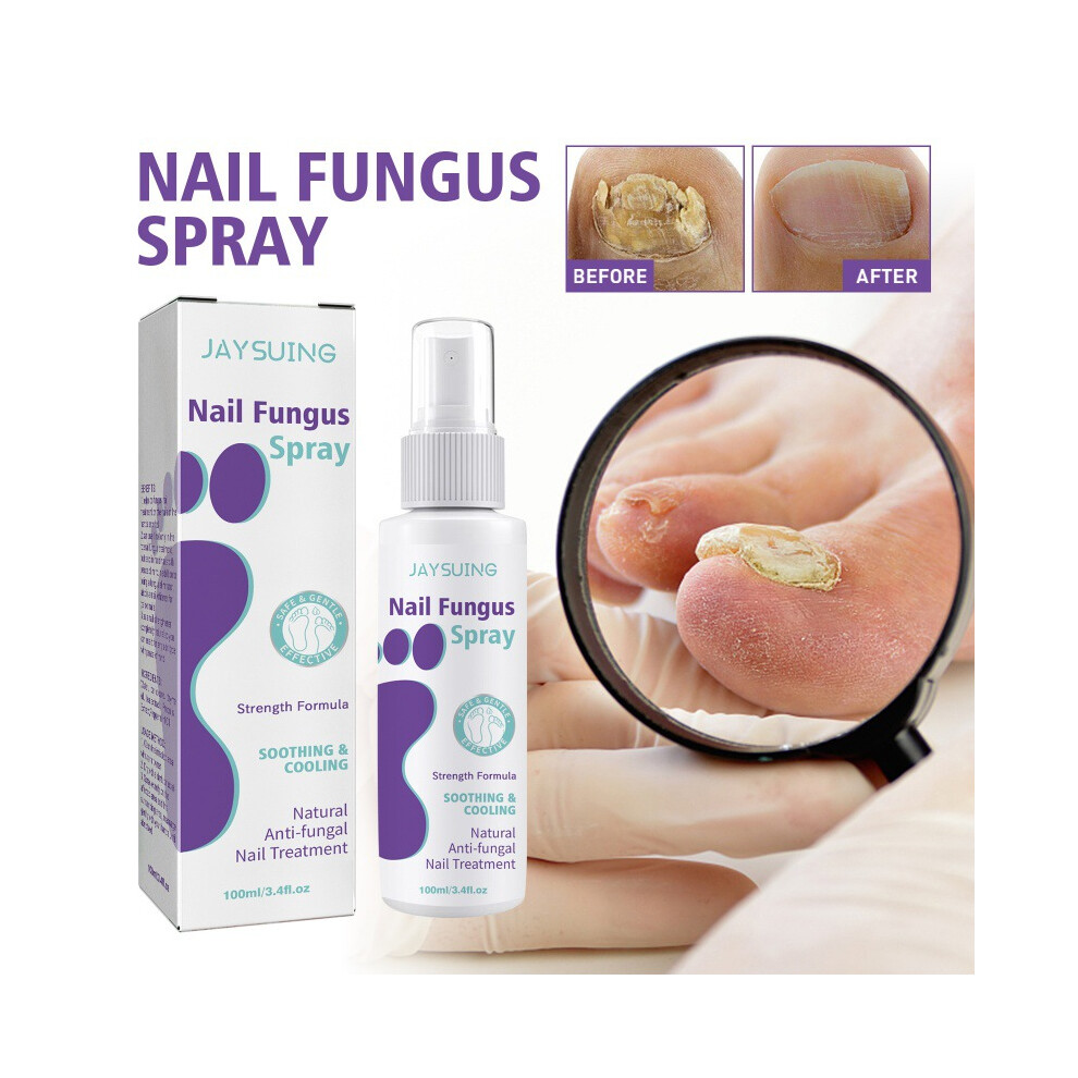 Repair Gray Nail Spray For Healthy Soft Nails And Thickened Cuticles