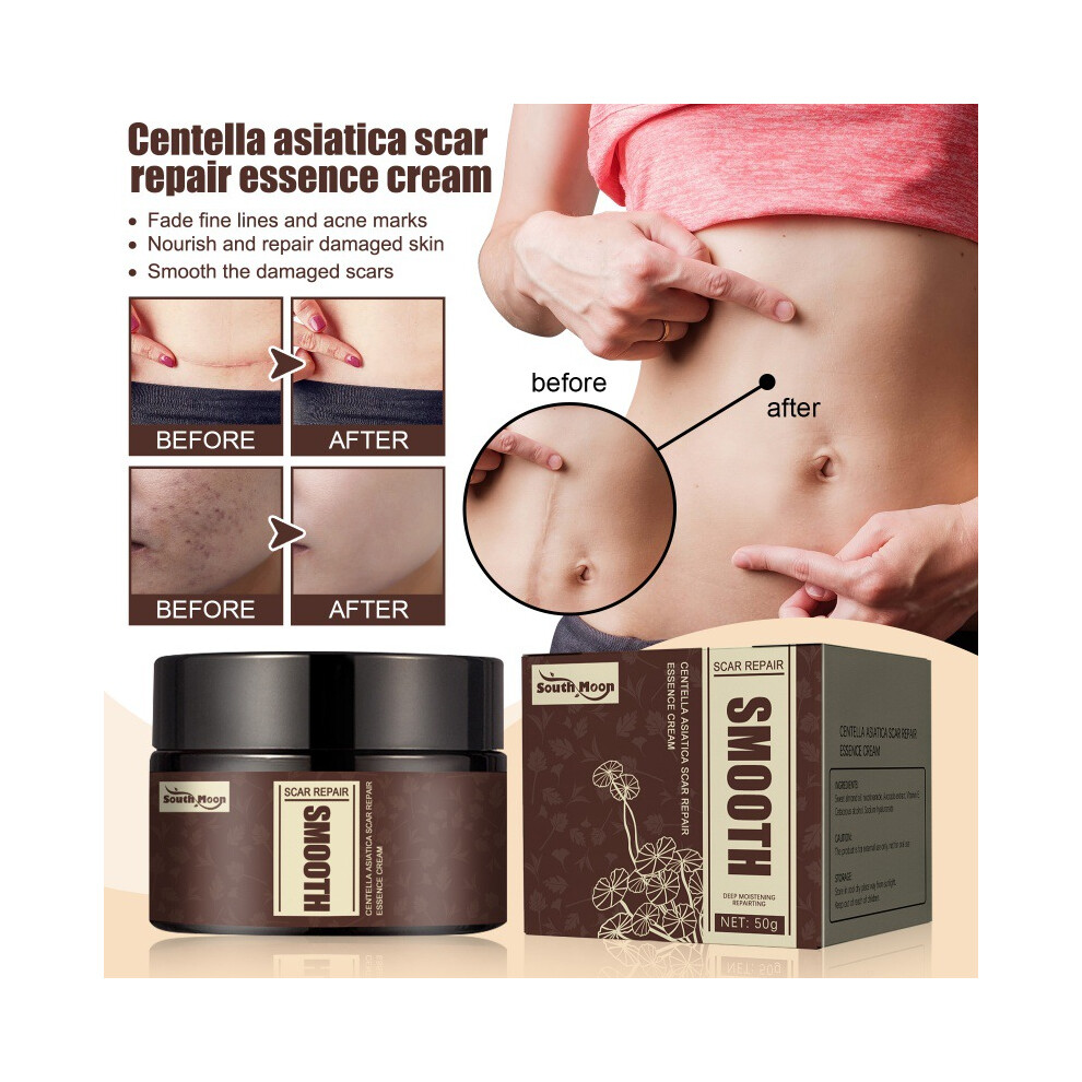 Centella Scar Soothing Cream Silky Smooth Hydrating And Skin Tightening Cream For Effective Scar Care