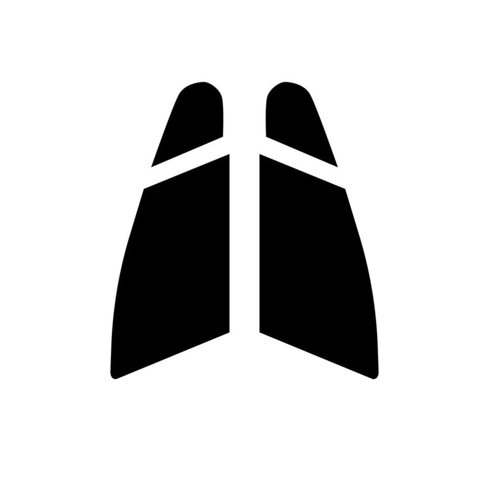 (Front Windows: 70% Ultra/Ultra Light Smoke) Pre Cut Window Tint for Peugeot 308 Estate - 2008 to 2013-image-OPC-PFHGXXJ-NEW