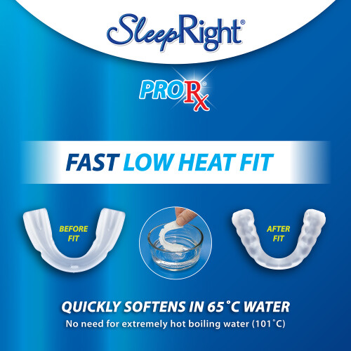 ProRx Custom Dental Guard - Extremely Durable and Long Lasting 1
