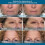 Plexaderm Rapid Reduction Eye Serum - Advanced Formula Anti Aging Visi 5