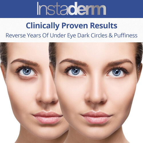 Instaderm Κρέμα Βιταμίνης Κ- Συνταγή Θεραπείας Μώλωπες με Άρνικα 2
