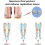 (Size 43-45) Supination Insoles For Over Supination 6