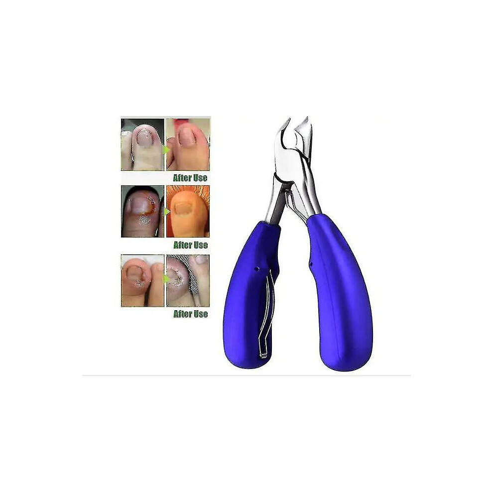 Xox-professional Toenail Clippers For Thick Or Ingrown Toenails - Precision Nail Clippers With Straight Lines
