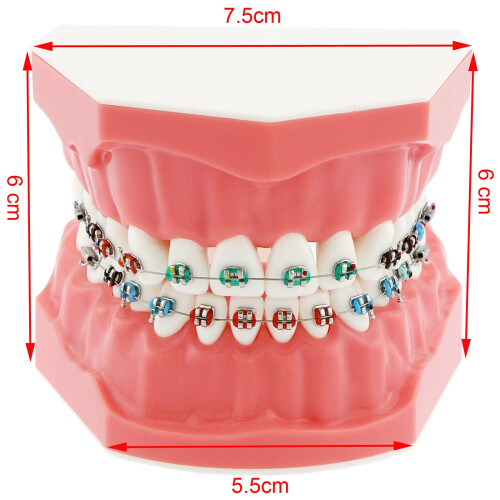 Dentalmall Typodonts Ορθοδοντικής Μοντέλο Επίδειξης με Μεταλλικά Καλώδια και Στηρίγματα 2
