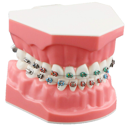 Dentalmall Typodonts Ορθοδοντικής Μοντέλο Επίδειξης με Μεταλλικά Καλώδια και Στηρίγματα 1