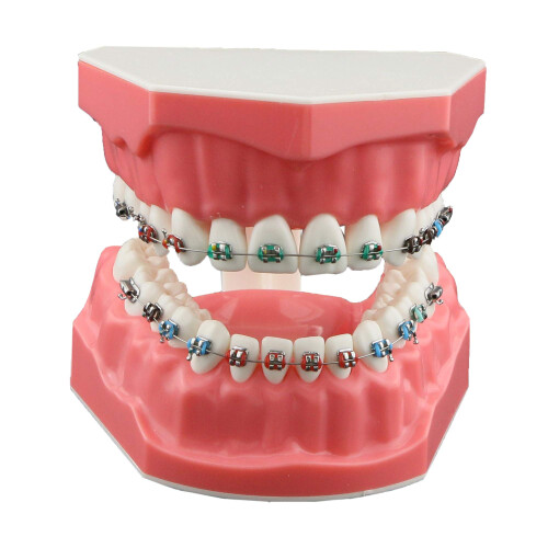 Dentalmall Typodonts Ορθοδοντικής Μοντέλο Επίδειξης με Μεταλλικά Καλώδια και Στηρίγματα