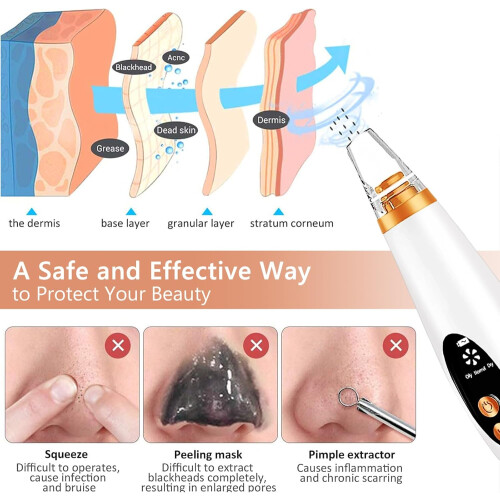 Chronus High-Efficiency Blackhead Remover - Electric Pore Cleaner with LED Display, Multi-Function Suction Cup, and USB Rechargeable Feature(White) 1