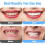 Veneer Dentures Set, 2pack Upper And Lower False Teeth, Bright White Shade, Comfortable 2