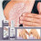 Psoriasis For Psoriasis Psoriasis 5