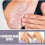Psoriasis For Psoriasis Psoriasis 4