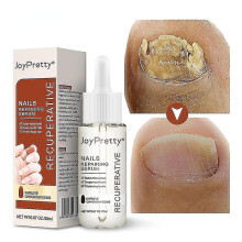 Fungal Nail Care Essence Foot Repair Essence Toe Whitening Treatment, Anti-infective Gel, 20 Ml