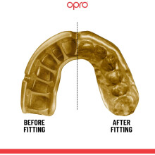 OPRO Gold Level Mouthguard, Adults Kids Sports Mouth Guard Featuring Revolutionary Fitting Technology for Boxing, Lacrosse MMA Martial Arts Hockey