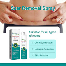 Scar Removal Spray For Acne Scars Surgical Scars And Stretch Marks