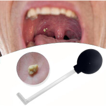 Tonsil Stone Remover Vacuum, Tonsil Stone Removal Kit Tool Tonsil Stone Treatment Oral Suction Tool, Dental Suction Mouth Cleaner Mouth Cleaning Oral