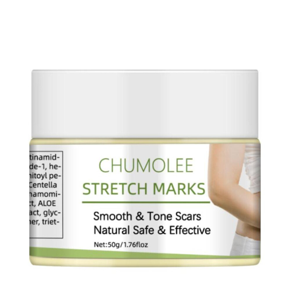 Stretch Marks Remover Cream Moisturizing Repair Pregnancy Scars Anti Winkle Firming Maternity Skin Care