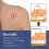 Hpv Remover  Wart Remover  Fast-acting 4