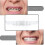 Dentures Tooth Cover Set-yky 2