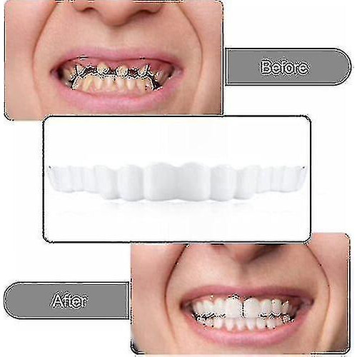 Dentures Tooth Cover Set-yky 1