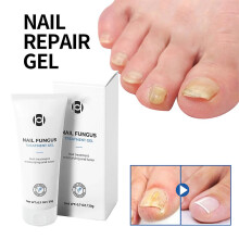 (1pc) 1-3pcs Healio Nail Treatment Gel Nail Care Gel Nail Thickening Nail Brightening Nail