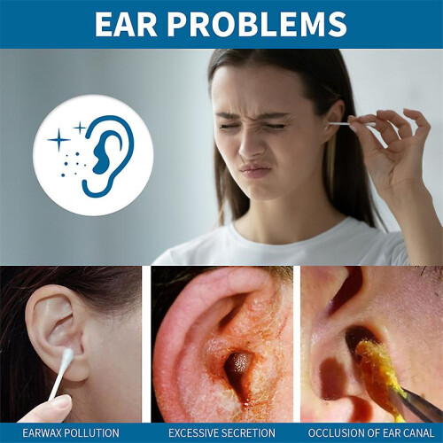 Ear Spray For Itchy Ears Ear Drops 2