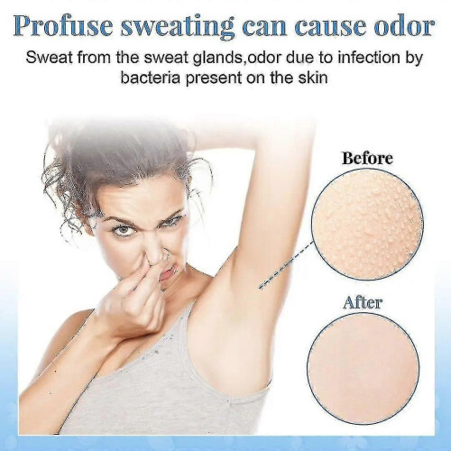 X 3 Bouteille Gh Protect+ Déodorant Anti-transpirant Roll-on Taille 100 Ml. 2