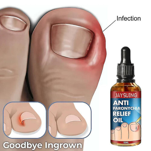Anti Nail Break Relief Oil 10ml 1