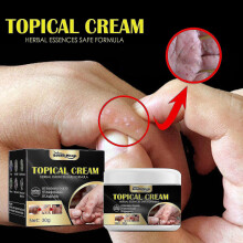South Moon Anti-itch Cream for Sweaty Hands And Feet Dry Itchy Skin Itchy Mosquito Bites Repair Cream