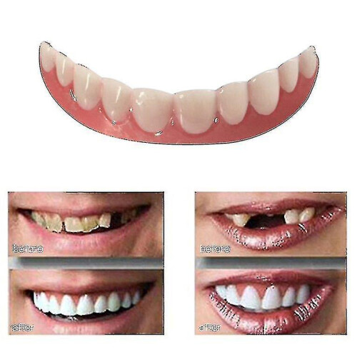 Instant Smile Comfort Fit Flex Teeth Whitening Denture Paste Cover_y High Quality