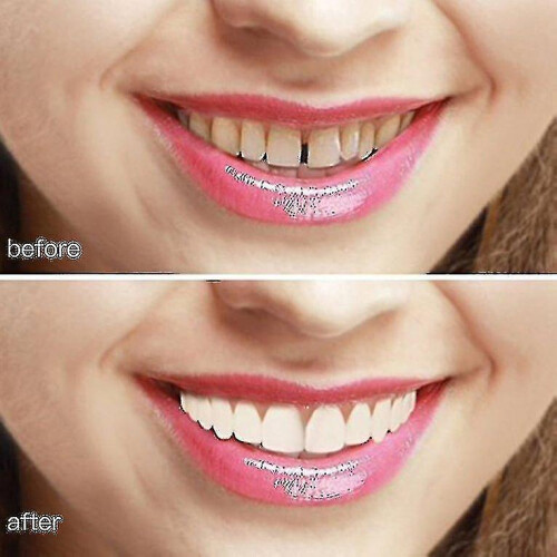 Instant Smile Comfort Fit Flex Teeth Whitening Denture Paste Cover_y High Quality 1