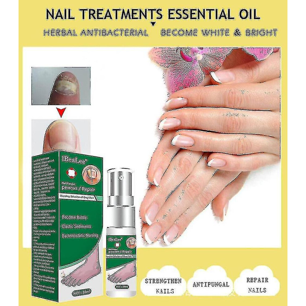 (1PCS) Nail Repair Fluid Fingernail And Toenail Repair Toe Nail Solution Strengthen Damaged Nails Repair And Protect Toenail-image-OPC-PFSSVPG-NEW
