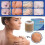 Scar Silicone Scar Stickers 3