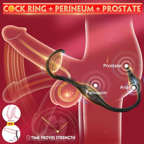4-in-1 Prostate Massager with Vibrating Cock Ring & Anal Plug 1