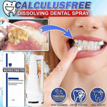 30ml Calculusfree Dissolving Dental Spray, Dental Calculus Remover Teeth Cleaner