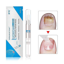 3ml Fungal Nail Cuticle Remover Fungal Treatment Nail Polish Pen Anti