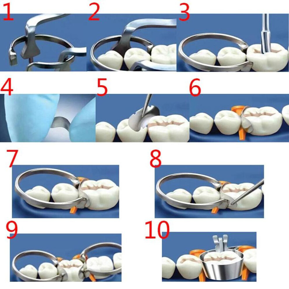 100pcs 35um Dental Matrix Cross-section Profile Metal Matrix 2 Rings