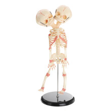 Dubbele Hoofd Baby Anatomie Schedel Skelet Anatomische Hersen Anatomie Educatie Medisch Model