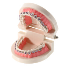 Tandheelkundige tanden malocclusie orthodontisch model met volledig metalen brackets en ringen voor tandartsopleiding