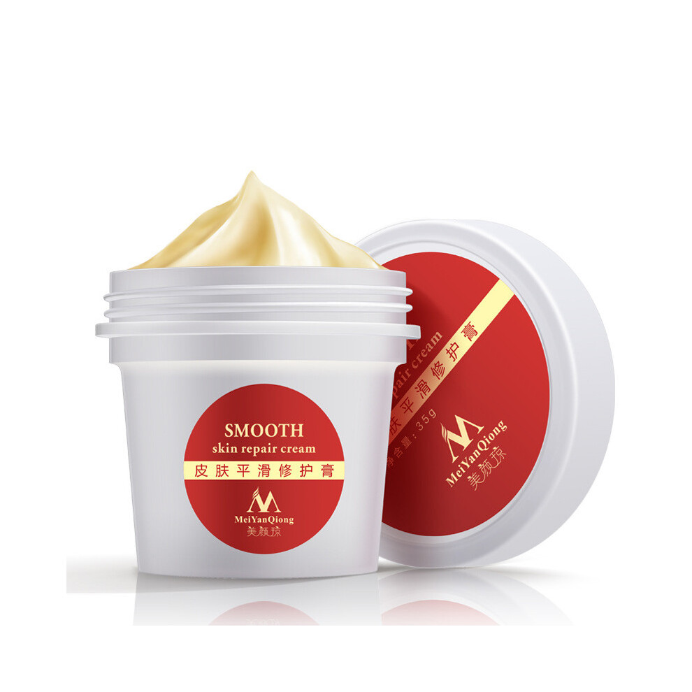 Cream Meiyanqiong Stretch Marks Repairing Scar Removal Maternity Skin Care Postpartum Smooth