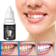 10 Ml Crema Sbiancante per Denti Rimuove Macchie di Denti Neri Denti Gialli Macchie di Tè Cura dei Denti