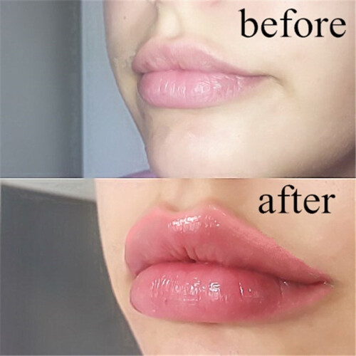 Automatic Lips Plumper Electric Plumping Device Beauty Tool Fuller Bigger Thicker Lips 2