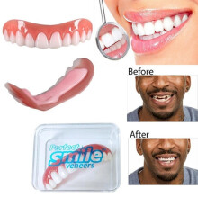 Fibbia cosmetica Sorriso perfetto Vestibilità comoda Braces elastiche